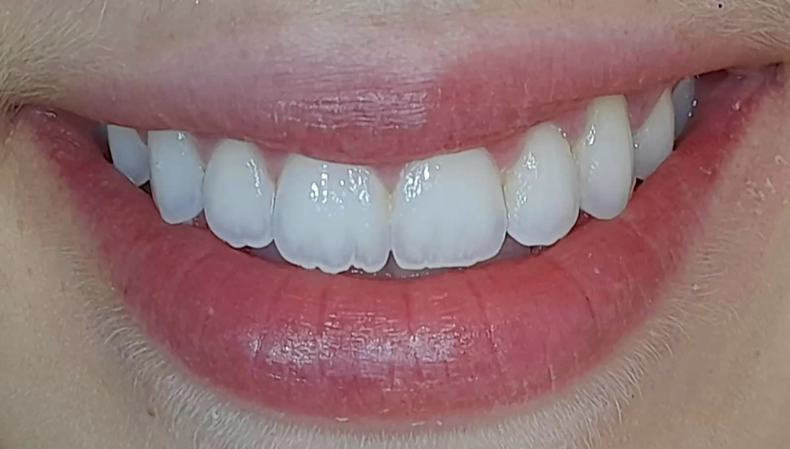 Before Edge Bonding