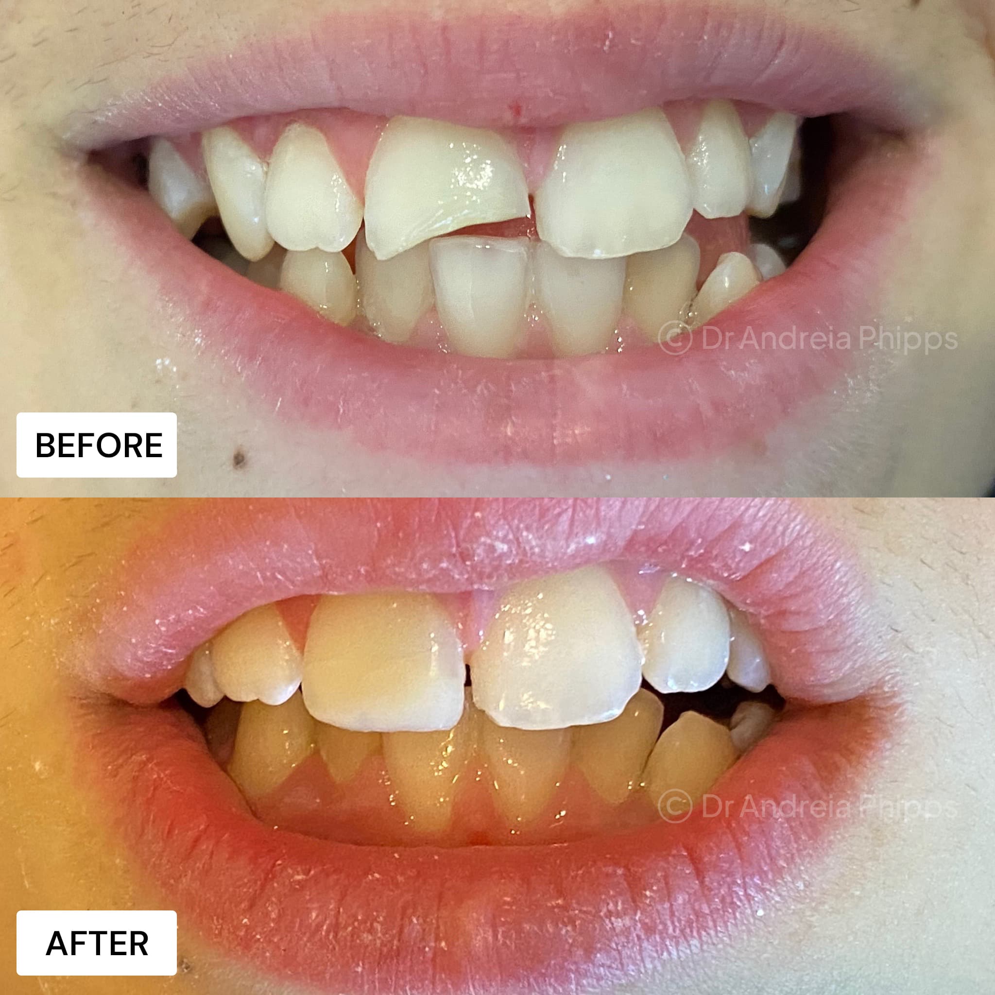 Smile transformation 9