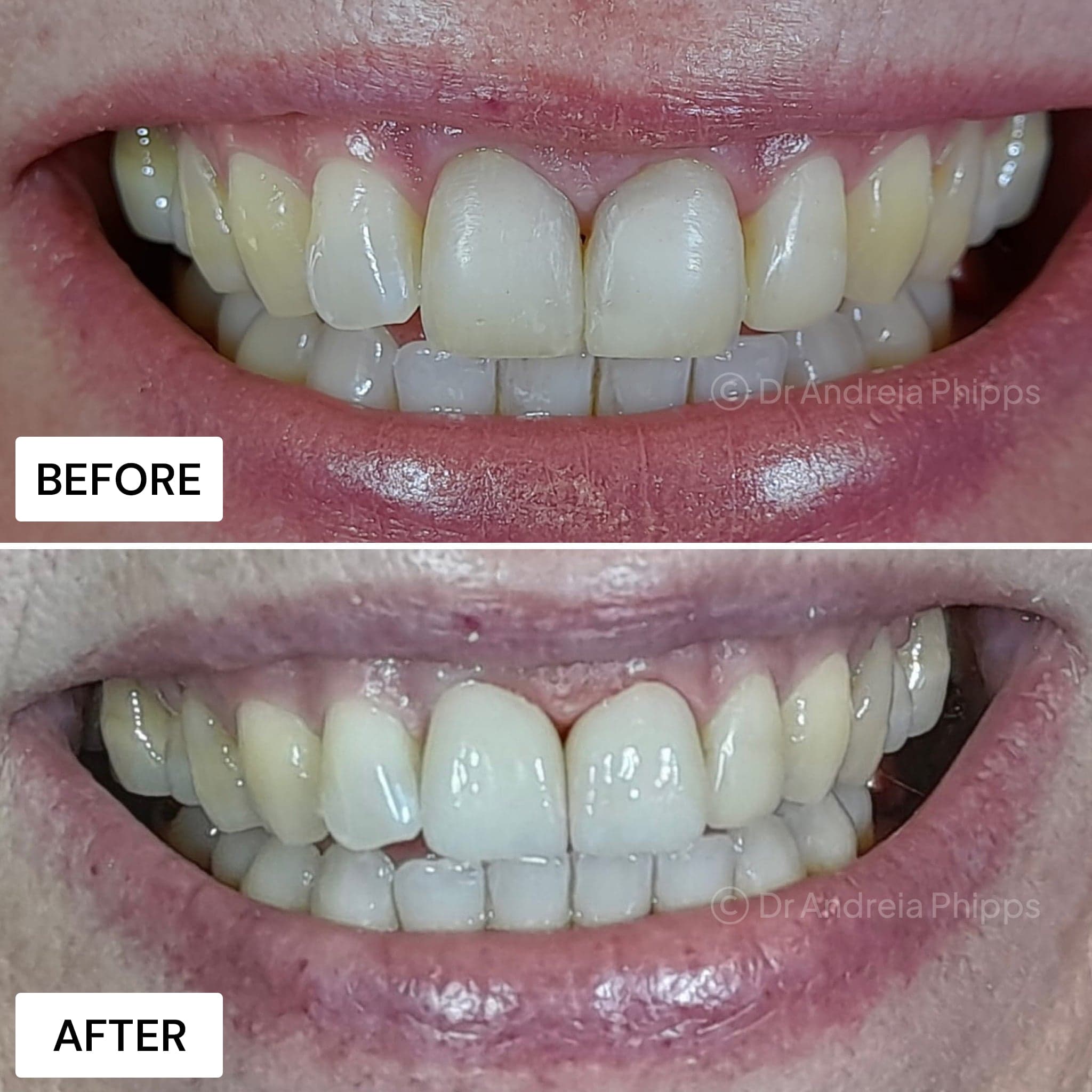 Smile transformation 10