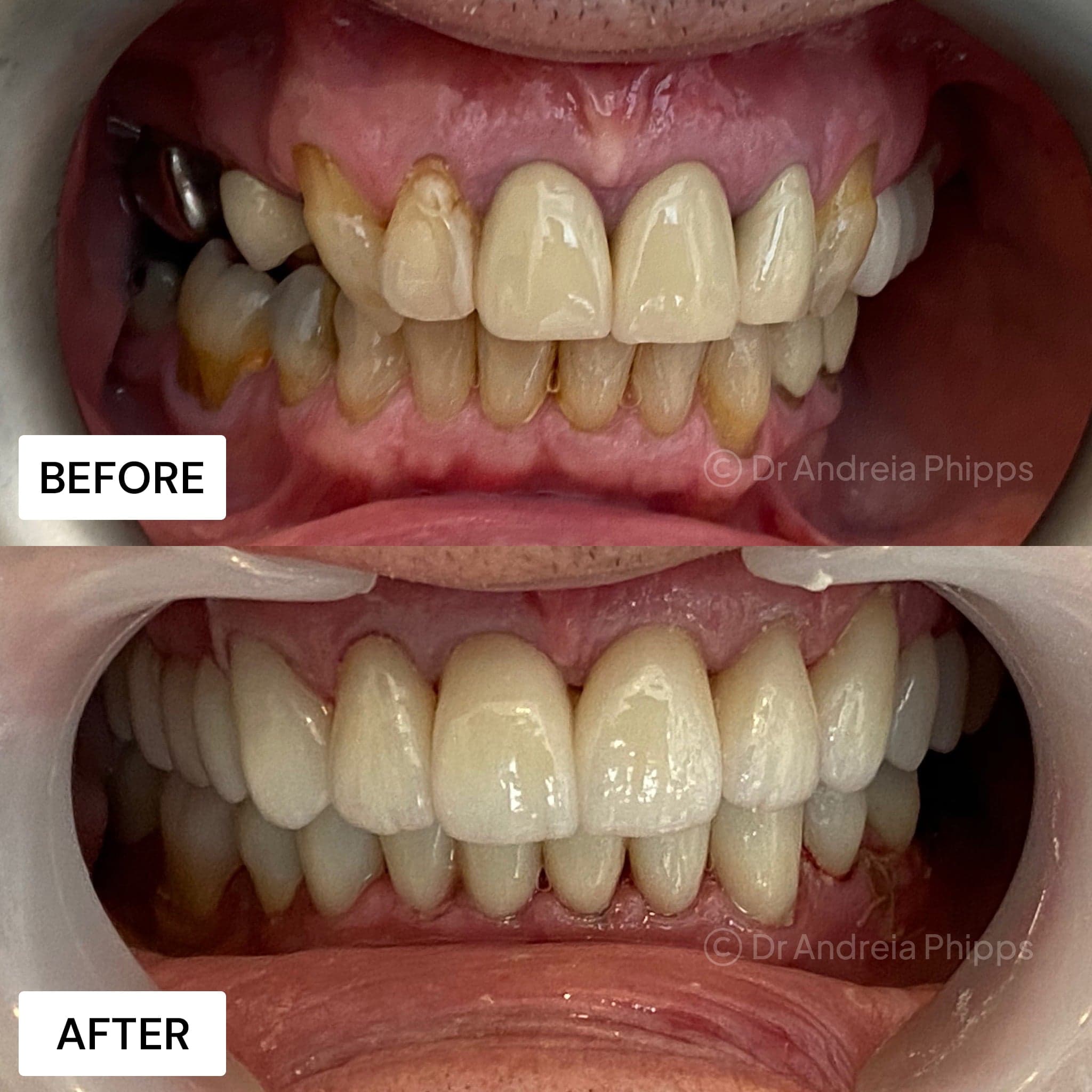 Smile transformation 12